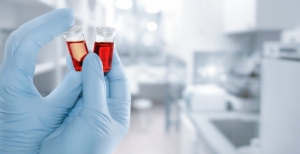 Leucemia: descoberto mecanismo que pode aumentar a eficiência da quimioterapia