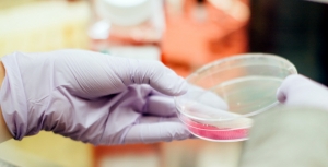 Comissão Europeia aprova daratumumab para o tratamento do mieloma múltiplo