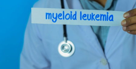 Otimização do tratamento de suporte na leucemia mieloide aguda