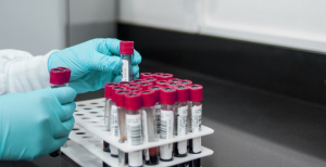 Estudo indica que cancro de mama pode ser detetado mais cedo com teste de sangue