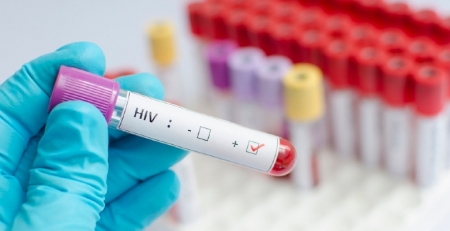 Doente com VIH no Brasil pode ser o primeiro curado apenas com medicação